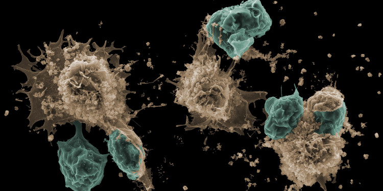 This scanning electron microscopy image captures the moment where degranulating mast cells (sepia) attract and start to incorporate living neutrophils (cyan).<address>© Marcus Frank und Karoline Schulz, Universitätsmedizin Rostock</address>